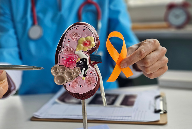 A doctor pointing to a model of a kidney