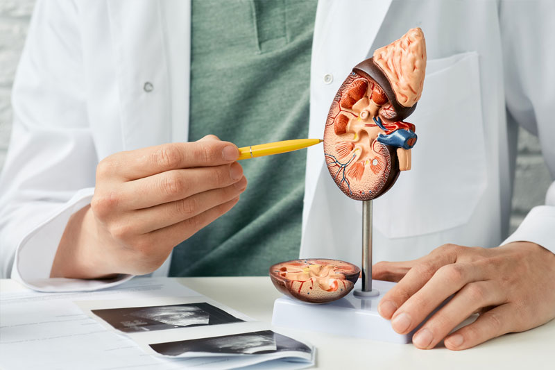 A doctor pointing to a model of a kidney with kidney stones