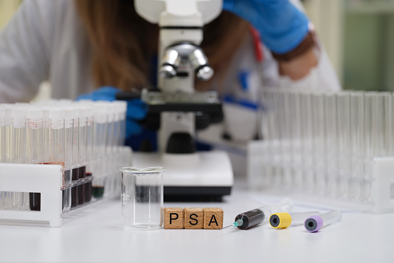 A lab technician conducting a PSA test