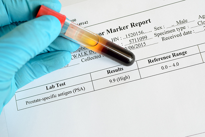 An example of a PSA test